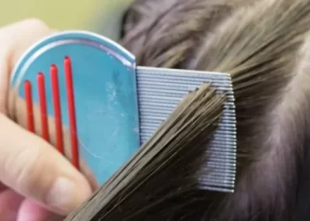 مؤسسة تابعة للبعثة الفرنسية بمراكش تحذر من القمل